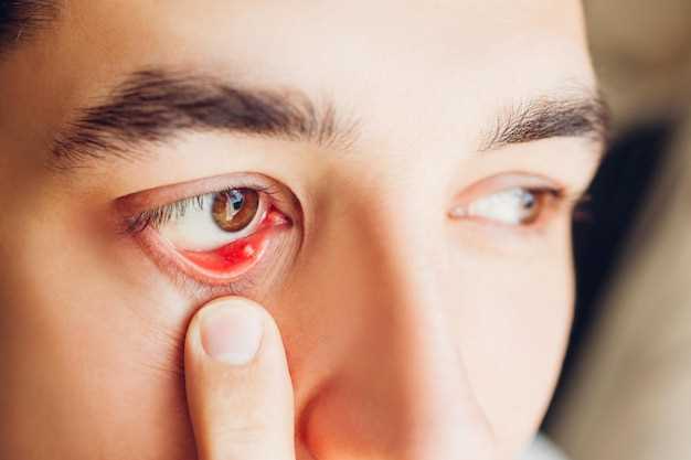 Как определить травму глаза