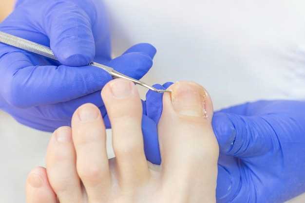 Как лечить трещины на ногтях?
