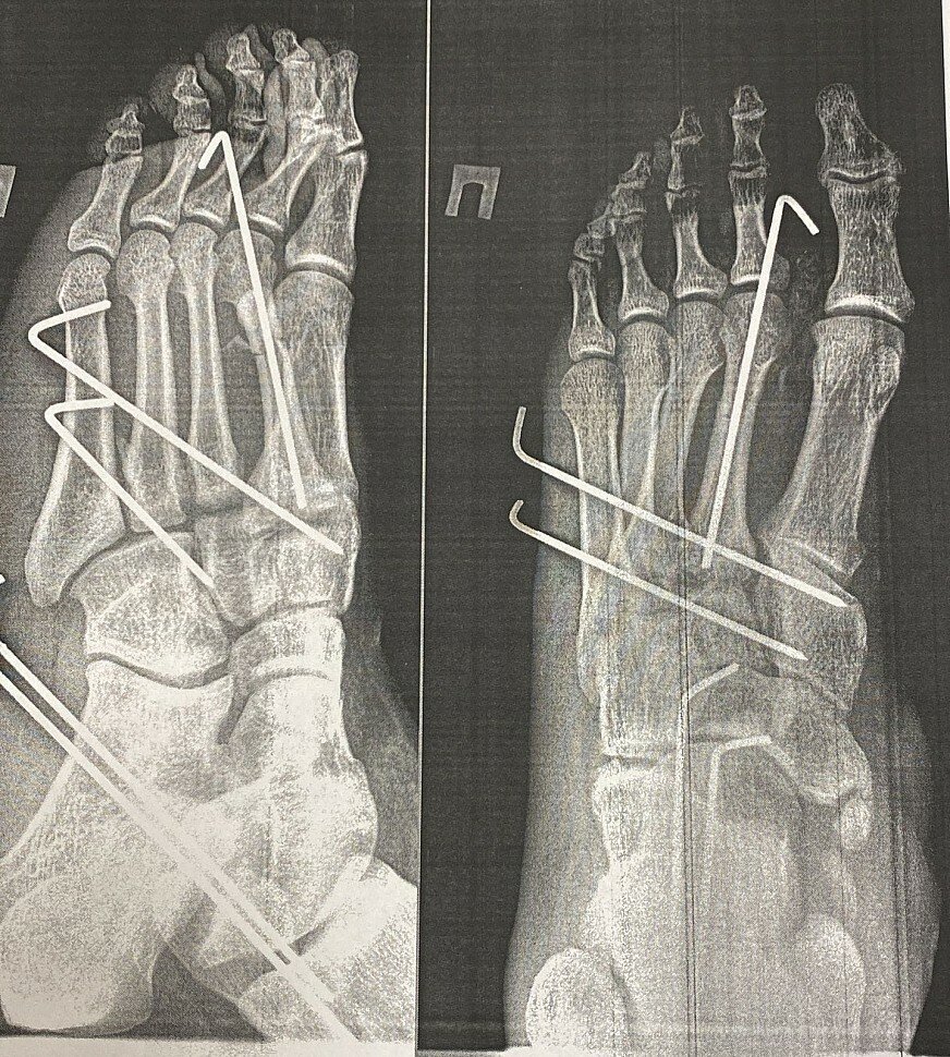 bones-01